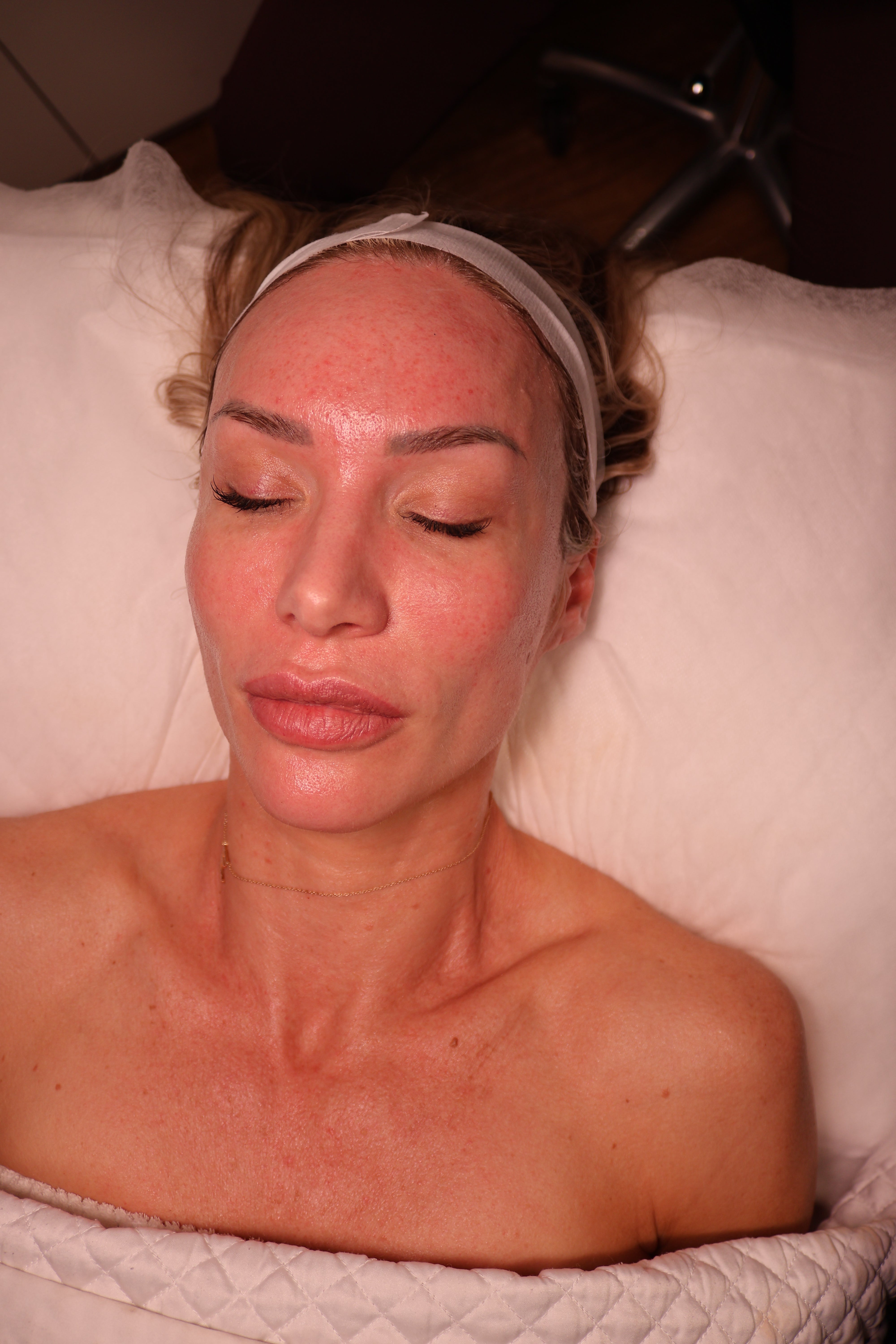 Lift & Firm Skin Tightening Package